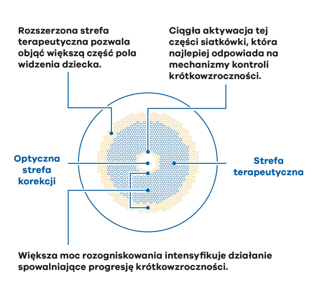 Budowa soczewki MiYOSMART iQ: optyczna strefa korekcji w centrum i rozszerzona strefa terapeutyczna